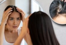 هل يمكن للتوتر أو الخوف أو الحزن أن يسبب شيب الشعر؟ Can stress, fear or sadness cause gray hair?