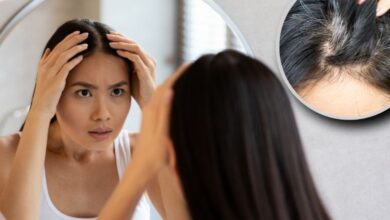 هل يمكن للتوتر أو الخوف أو الحزن أن يسبب شيب الشعر؟ Can stress, fear or sadness cause gray hair?