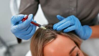 حقن الأكسوزوم لعلاج الصلع وتحفيز نمو الشعر Exosome injections to treat baldness and stimulate hair growth